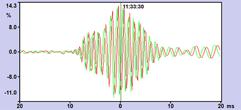 Embolie Audiogram