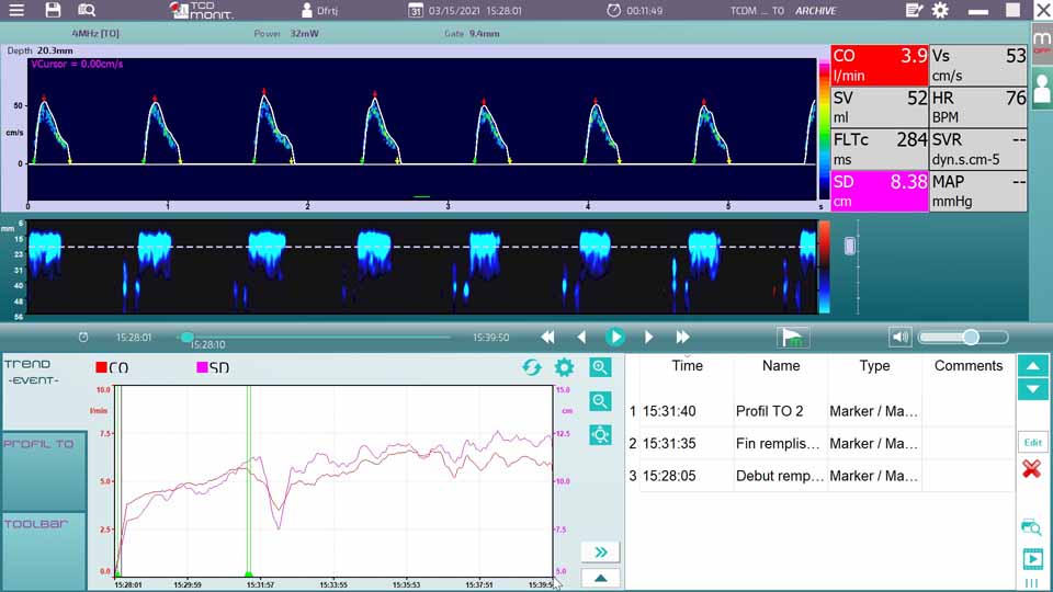 Cardiac Output Monitor WAKI-TO