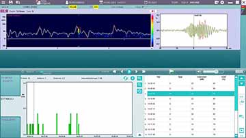 Micro Embolie Detectie Software