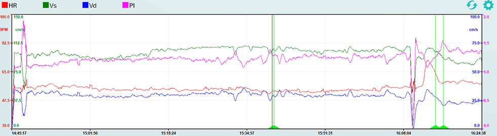 Trendweerfgave Indexen